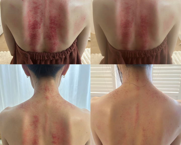 【かっさ経過の変化】