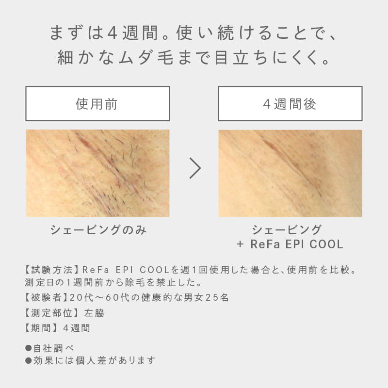 リファエピ クール